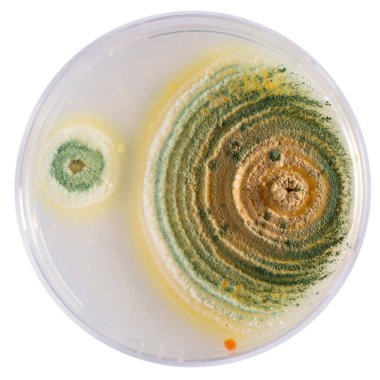 Petri kabında büyüyen farklı renkte kalıp eşmerkezli dairesel desen oluşturuyor.