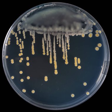 Mikrobiyoloji araştırma ve analizlerinde kullanılan sarı noktalar oluşturan büyüyen bakteri kolonileriyle dolu bir petri kabı.