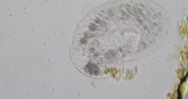 Paramesyum aurelia, tek hücreli silikat protozoanı, mikroskop altında hareket eder ve döner.