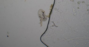 Paramesiyum aurelia 'nın mikroskobik görüntüsü organik enkaz etrafında hareket ediyor