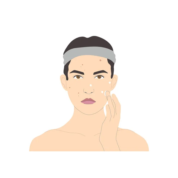 整容面部护理 带有粉刺 皮疹或痤疮的悲伤妇女应用治疗产品 白色背景上分离的病媒 矢量说明 — 图库矢量图片