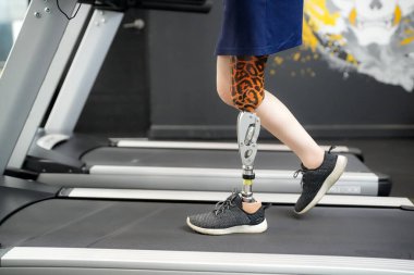 Spor salonunda protez bacaklı engelli bir sporcunun portresi.