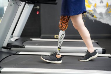 Spor salonunda protez bacaklı engelli bir sporcunun portresi.