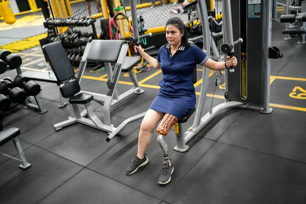 Portrait of disabled athlete woman with prosthetic leg in fitness. Closeup on bionic prosthetic leg.