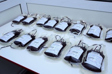 Üzerinde kan olan konteynırlar hastane laboratuarının çalışma odasına konmuş. 5 Nisan 2022. Kyiv, Ukrayna