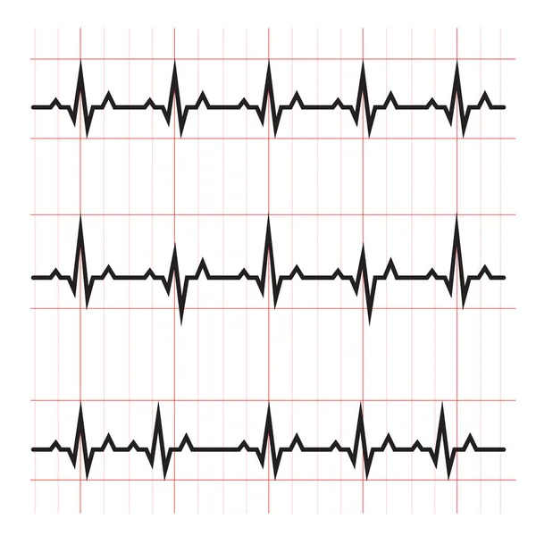 Normal Och Onormal Ekg Kardiogram Diagram Schematisk Raster Illustration Medicinsk — Stockfoto
