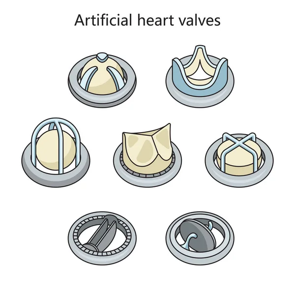 Kunstmatige Hartklep Implantaat Menselijk Hartdiagram Schematische Raster Illustratie Educatieve Illustratie — Stockfoto