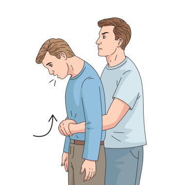 Abdominal itme ilk yardım prosedürü Heimlich manevra diyagramı elle çizilmiş şematik raster çizimi. Tıp bilimi eğitimsel illüstrasyon