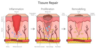 Tissue repair structure diagram hand drawn schematic raster illustration. Medical science educational illustration clipart