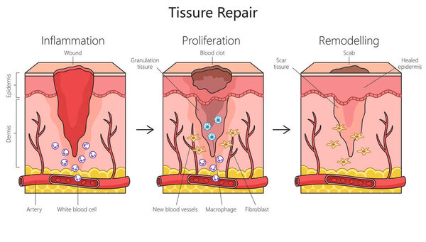 Диаграмма структуры ремонта тканей нарисована вручную схематической растровой иллюстрацией. Образовательная иллюстрация