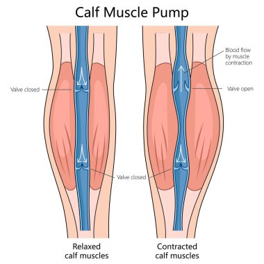 blood flow in relaxed and contracted calf muscles, indicating valve positions and muscle states structure diagram hand drawn schematic vector illustration. Medical science educational illustration clipart