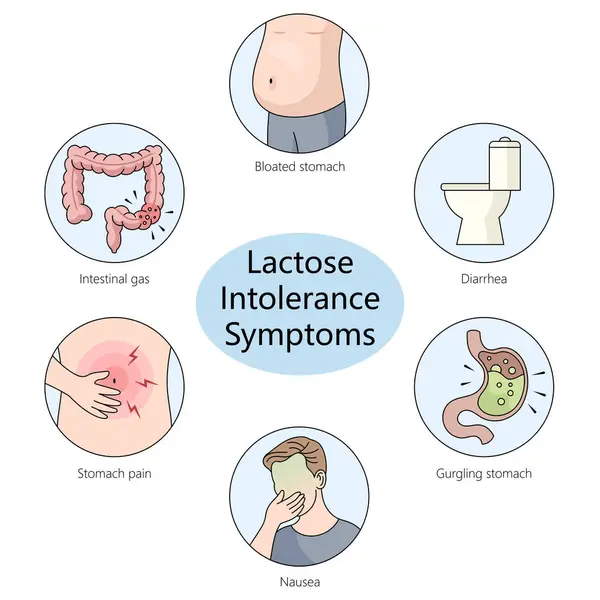 Diagrama Que Representa Los Síntomas Típicos Asociados Con Intolerancia Lactosa — Archivo Imágenes Vectoriales