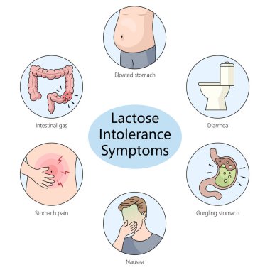  Laktoz intoleransı ile ilişkili tipik semptomları tasvir eden diyagram, şişkinlik ve ishal el çizimi şematik raster çizimi gibi. Tıp bilimi eğitimsel illüstrasyon