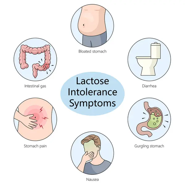 แผนภาพแสดงอาการท วไปท ยวข องก บการแพ แลคโตส อาการท องอ ดและท องร — ภาพถ่ายสต็อก