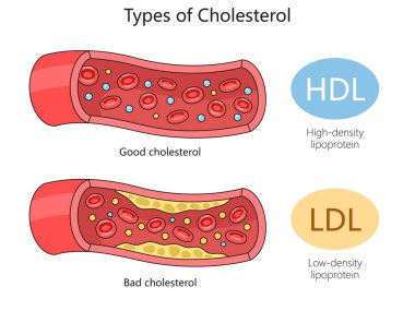 HDL iyi kolesterol ve LDL kötü kolesterol kan damarlarında el yapımı şematik raster çizimi için. Tıp bilimi eğitimsel illüstrasyon