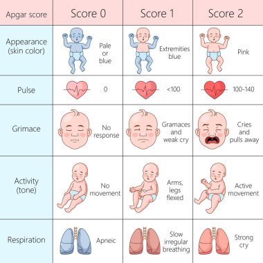 Apgar skor tablosu yenidoğanların sağlığını, görünüşünü, nabzını, ekşimesini, aktivitesini ve elle çizilmiş şematik raster çizimini değerlendiriyor. Tıp bilimi eğitimsel illüstrasyon