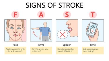 FAST inme işaretlerini gösteren bilgi, yüz düşüşü, kol zayıflığı, konuşma zorluğu, ve acil servis raster illüstrasyonunu arama zamanı. Tıp bilimi eğitimsel illüstrasyon