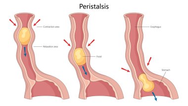 Yemek borusundaki peristaliz süreci kas kasılmalarını ve mide diyagramına doğru besin hareketlerini gösteriyor. El çizimi şematik raster çizimi. Tıp bilimi eğitimsel illüstrasyon