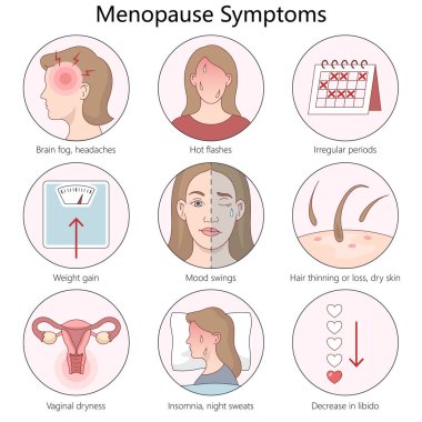 symptoms of menopause, including hot flashes, mood swings, insomnia, hair loss, and hormonal changes diagram hand drawn schematic vector illustration. Medical science educational illustration clipart