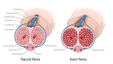 anatomical structures of a flaccid and erect penis, highlighting blood flow, cavernous arteries, and erectile tissue expansion diagram hand drawn raster illustration. Medical science educational