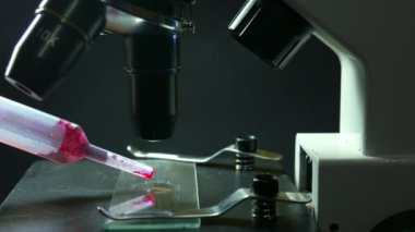 Mikroskop altında kan damlası, aşı araştırması. Bir bilim adamı virüs için kan testi yapar. Yukarıdan yakın görüntü