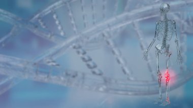 Diz ağrısı, diz ekleminde ya da çevresindeki bölgede meydana gelen rahatsızlık ya da ağrıya işaret eder.. 