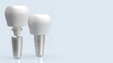 Diş implantları tipik olarak titanyum ya da titanyum alaşımı gibi biyouyumlu malzemelerden yapılır. Titanyum, insan vücuduyla mükemmel uyumluluğu ve reddedilme riski nedeniyle tercih edilir..