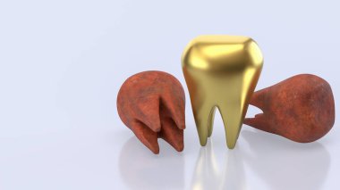 Diş Konsepti için altın dişler 3d Hazırlama.