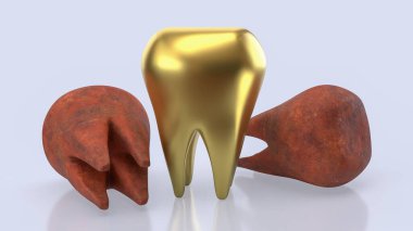 Diş Konsepti için altın dişler 3d Hazırlama.