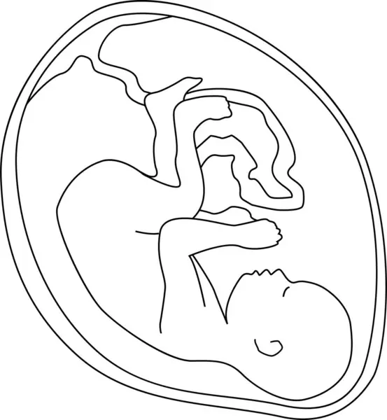  Ana rahmindeki bir bebek, başı aşağıda cenin pozisyonunda. Taslak vektör çizimi. Şeffaf arkaplan.