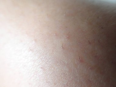 Bacağında insan derisi vardı.