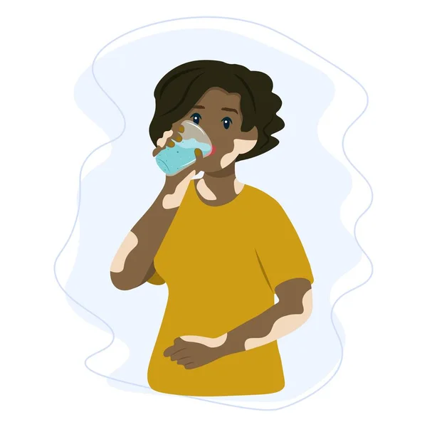 ビリゴ病の女性は新鮮な水を飲んでいます 健康で持続可能なライフスタイルコンセプト — ストックベクタ