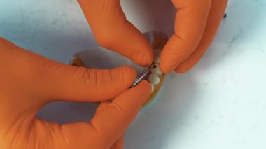 Klinik ortamlarda çeşitli ortodontik bileşenleri gösteren detaylı bir diş modelinin yakın çekimi