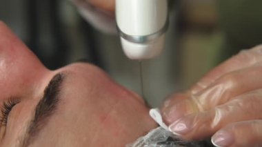 Bu metin cilt yenilenmesini ve beslenmesini arttırma amaçlı bir yüz prosedürünü tanımlar