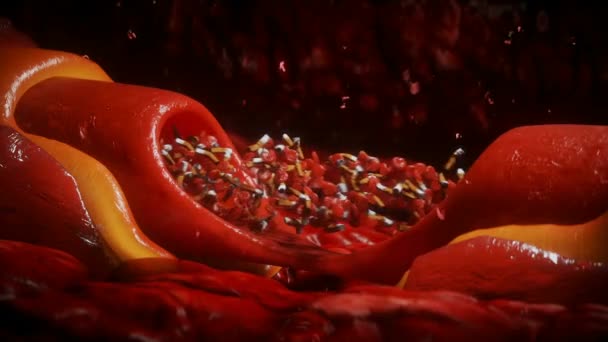 Strumień Krwi Niedopałki Papierosów Koncepcja Szkodliwego Wpływu Zdrowie Wewnątrz Ciała — Wideo stockowe