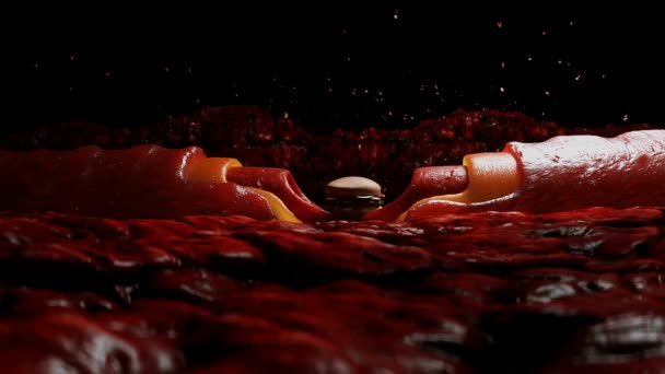 Malbouffe Sang Plaque Cholestérol Thrombus Concept Préjudice Pour Santé Intérieur — Video