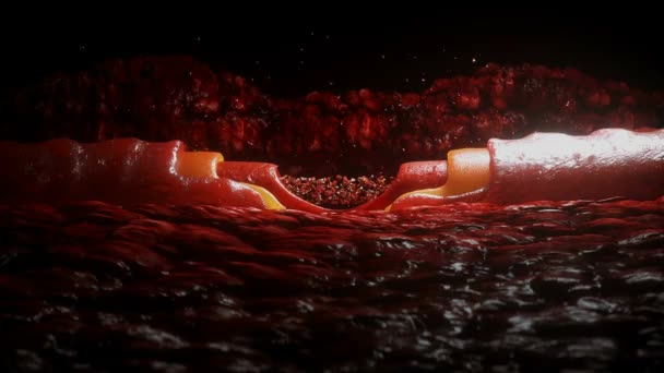 Кровотік Сигаретні Сідниці Куріння Концепції Шкоди Здоров Всередині Людського Тіла — стокове відео