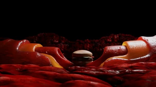 垃圾食品 血液流和胆固醇斑块血栓健康危害概念 人体内部 — 图库视频影像