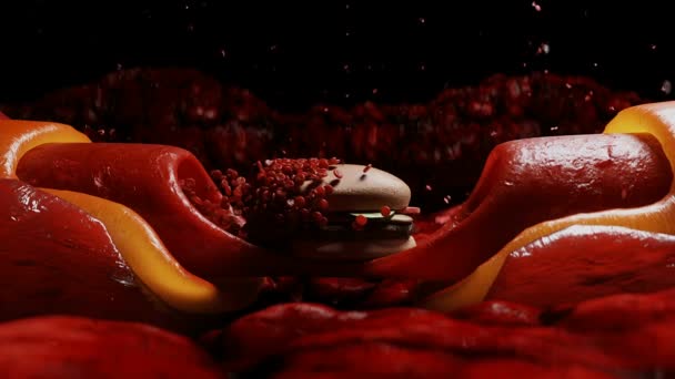 Comida Chatarra Flujo Sanguíneo Placa Colesterol Trombo Concepto Daño Salud — Vídeos de Stock