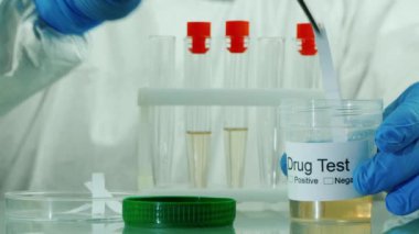 Laboratuvar teknisyenlerinin elleri doping veya uyuşturucu içeriği için idrar testi yapıyor.