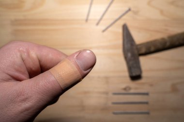 Alçılı bir erkek başparmak ve arka planda bir tezgah.