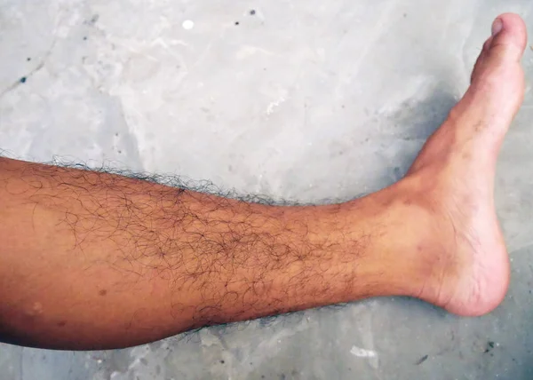 Азиатские Мужские Ноги Коричневые Тонкими Вьющимися Волосами Сухой Кожей — стоковое фото