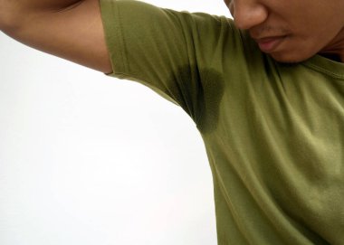 Hiperhidroz terinin sebep olduğu nahoş ifadeli bir adam. Beyaz arka planda kıyafetlerinde ter lekeleri olan genç Asyalı bir adam. Sağlık hizmeti kavramı.