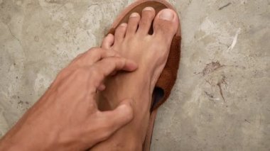Asyalı bir adam kaşınan cildiyle bacaklarını ve ayaklarını kaşıyordu. Mikroplar sebep olur.