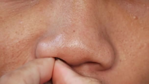Pria Asia Memetik Bulu Hidung Memanjang Dengan Tangannya — Stok Video