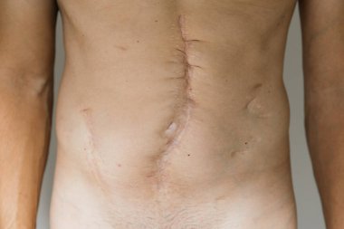 Erkek bir denek dik duruyor ve belirgin bir karın kesiği izi ortaya çıkıyor. Geçmişi nötr, son zamanlardaki ameliyatı yansıtan yaraya odaklanmış..