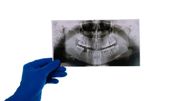 Zubař Držící Snímek Pacientova Zubu Izolovaného Bílém Pozadí Lékař Analyzuje — Stock fotografie