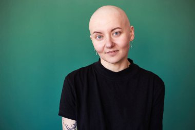 Kanserden muzdarip genç kadın gülüşü gelecekteki iyileşme hakkında olumlu düşünüyor. Milenyum dişisi, kafası kazınmış.