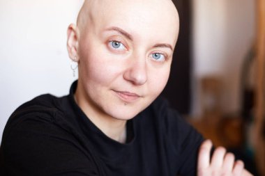 Kanserden muzdarip genç kadın gülüşü gelecekteki iyileşme hakkında olumlu düşünüyor. Milenyum dişisi, kafası kazınmış.