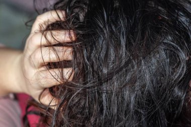 Koyu saçlı birinin yakın çekimi, muhtemelen kepek ya da kafa derisi rahatsızlığı belirtileri gösteriyor..